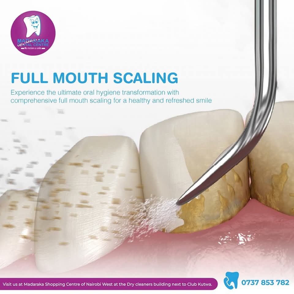 Periodontic Treatments