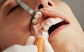 Preventive Dentistry